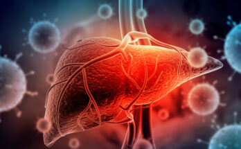 Hepatitis A Liver Disease Prevention And Treatment in Ahmedabad