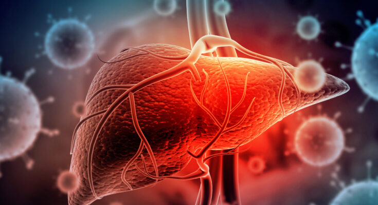 Hepatitis A Liver Disease Prevention And Treatment in Ahmedabad